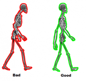 human skeleton bad vs good posture